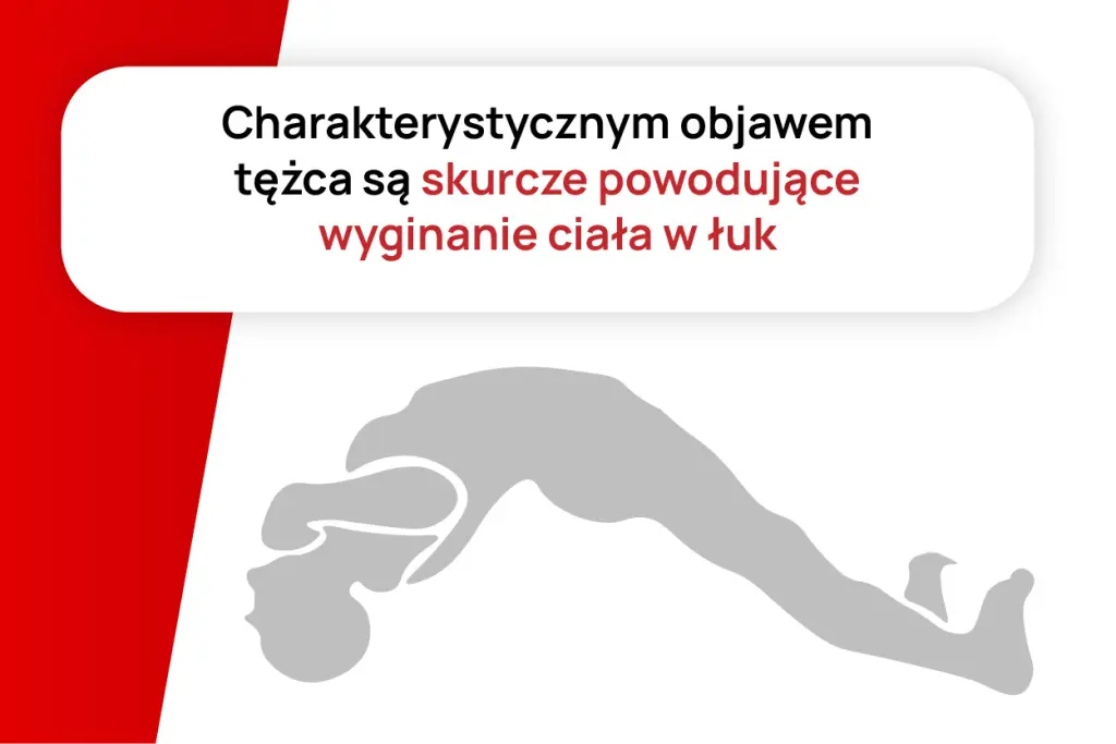 Objaw tężca: wyginanie ciała w łuk